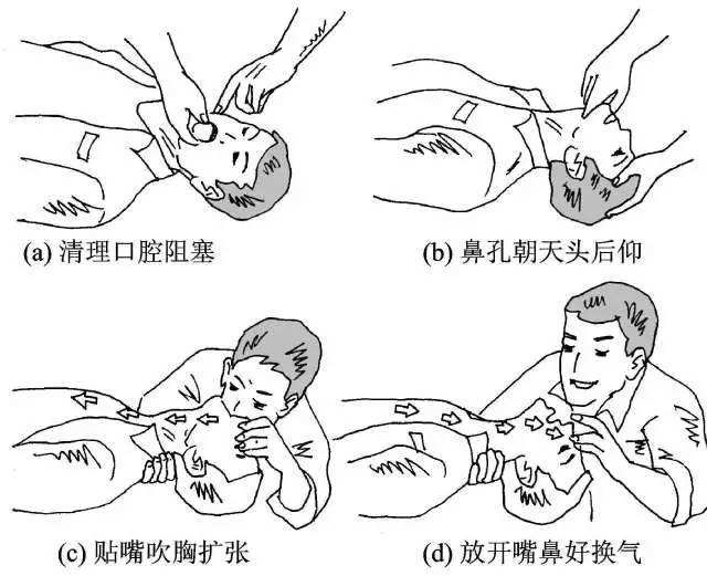人工呼吸 人工呼吸